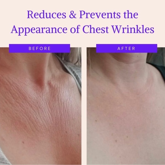 Chest Wrinkle Pads Anti-Wrinkle Silicone Patches Skin Firming & Smoothing 3pads - Picture 2 of 7